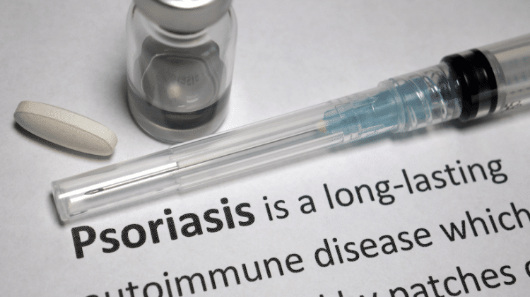 What is psoriasis_420.mt